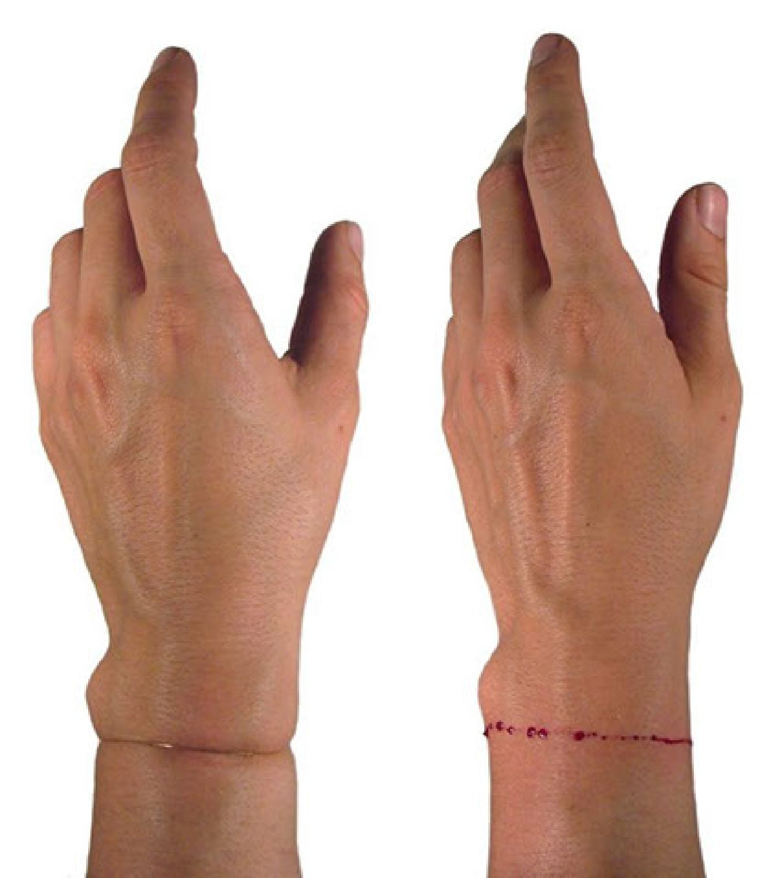Zoé Kiner Wolff  MB-B 2026 Fig.3